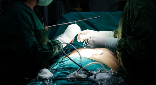 Depois da cirurgia bariátrica